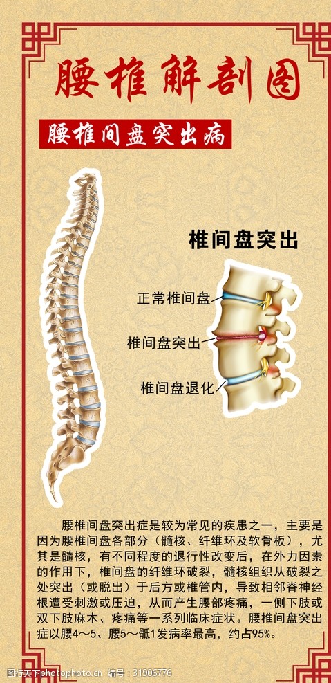 腰椎间盘突出腰椎解剖图