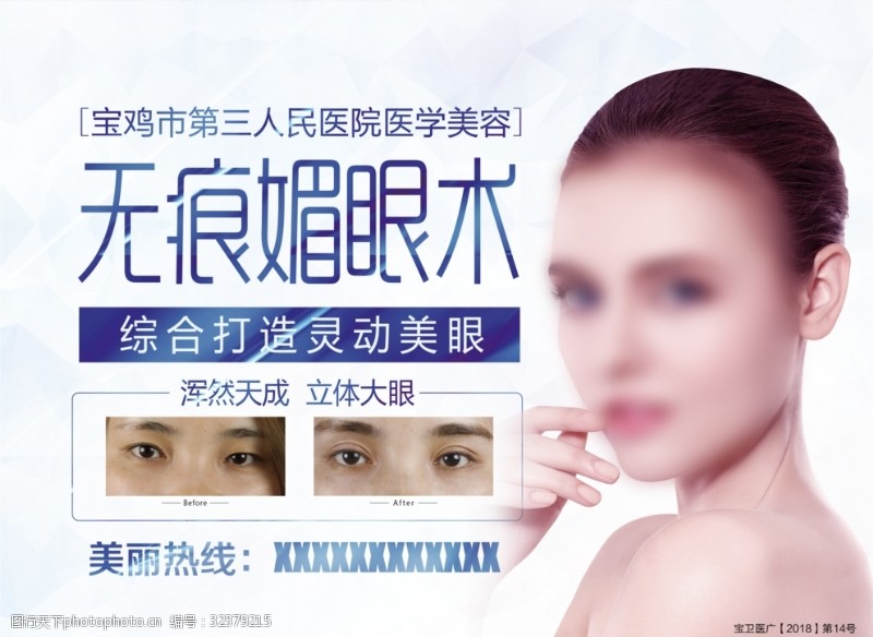 广电展架双眼皮广告双眼皮眼睛广告