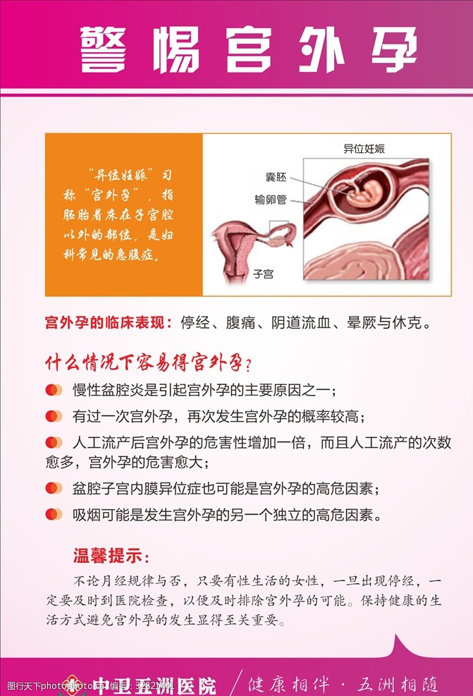 卵巢囊肿宫外孕