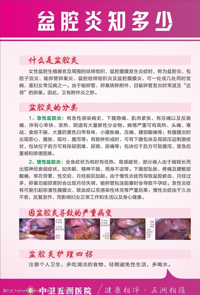 卵巢囊肿盆腔炎