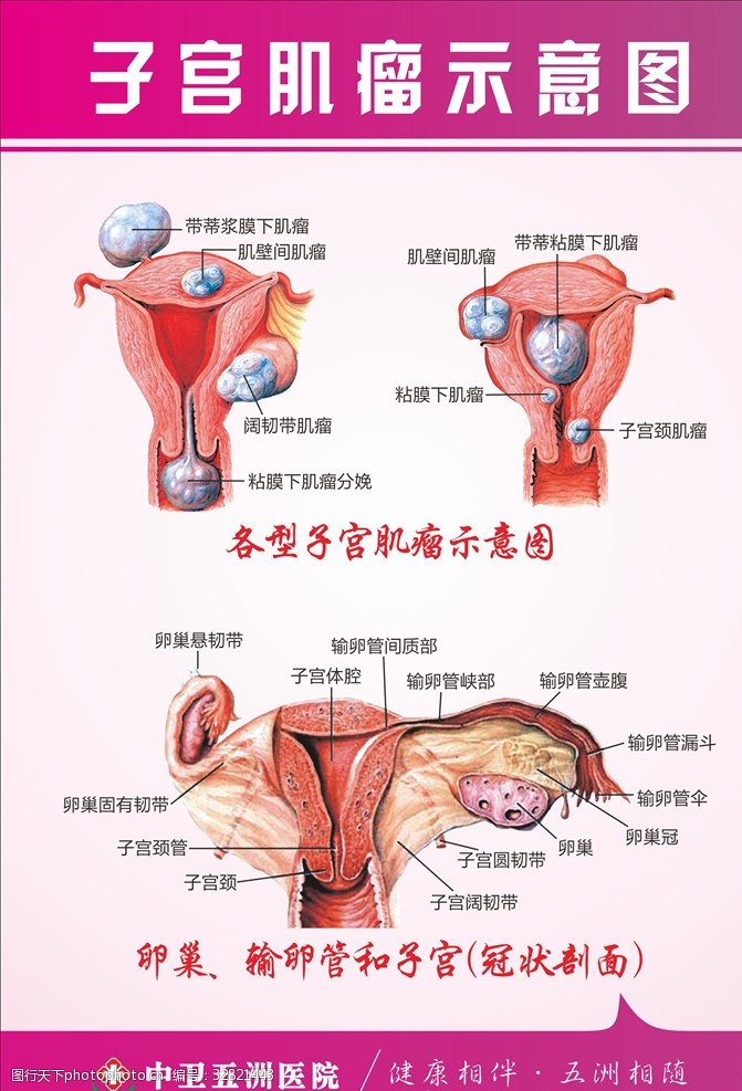 性功能障碍子宫肌瘤